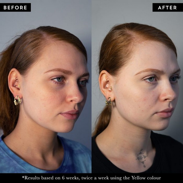how to turn on led face mask_2