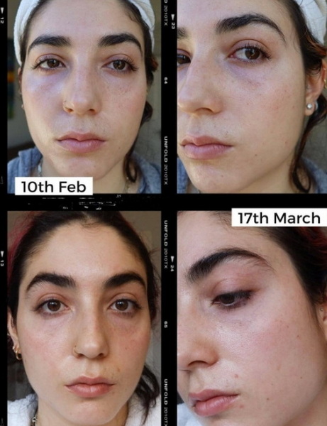 are all led face mask created equal_1
