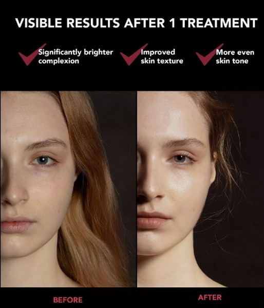 led face mask images_1