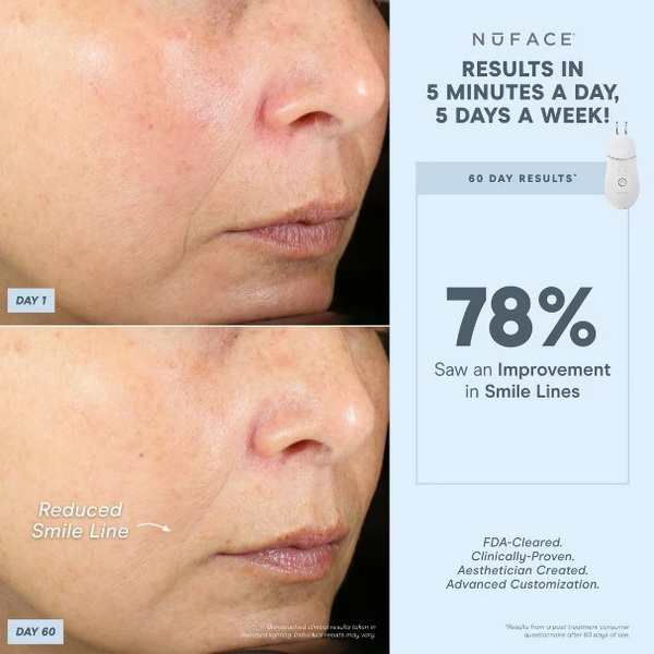 skinclinical reverse anti-aging red light therapy device vs nuface ele_2