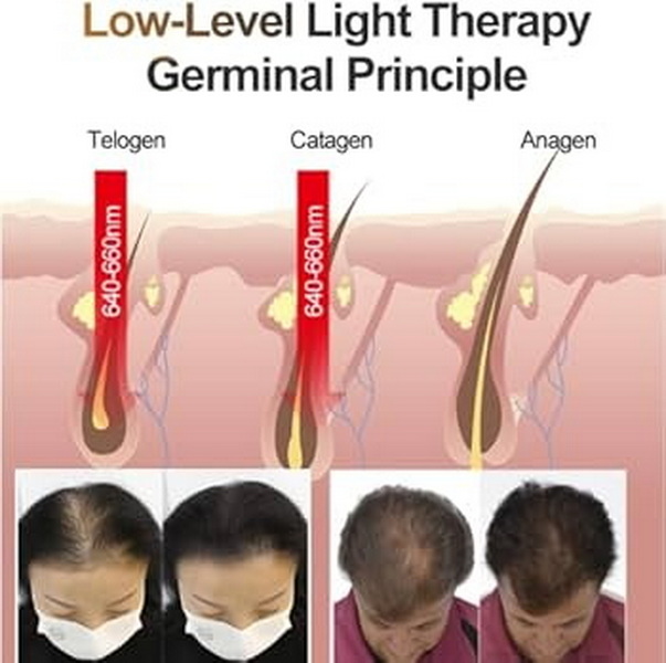 best red light therapy device for hair growth_1