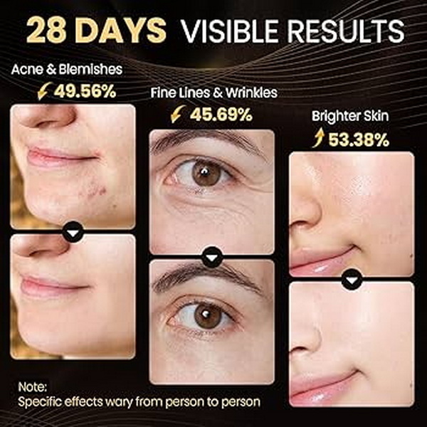 how long should you leave led face mask on_3