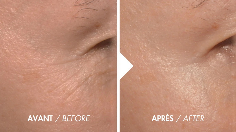 how long to see results from led face mask_3