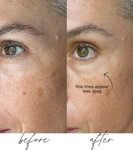 how long before you see results from led face mask_1