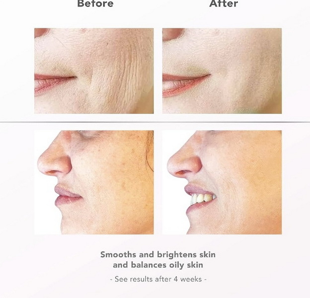 can i use led face mask after fillers_3