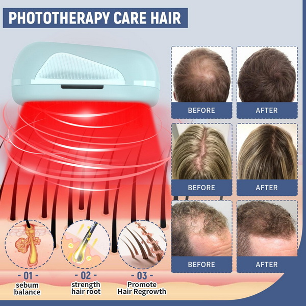 best red light therapy device for hair growth_3