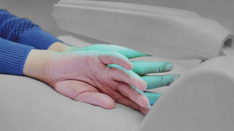 best red light therapy device for psoriasis_1