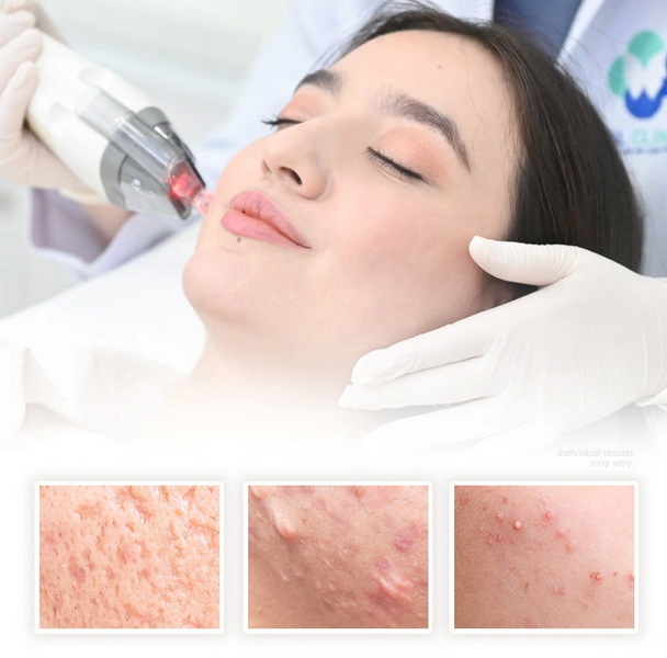 professional medical grade red light therapy device_2