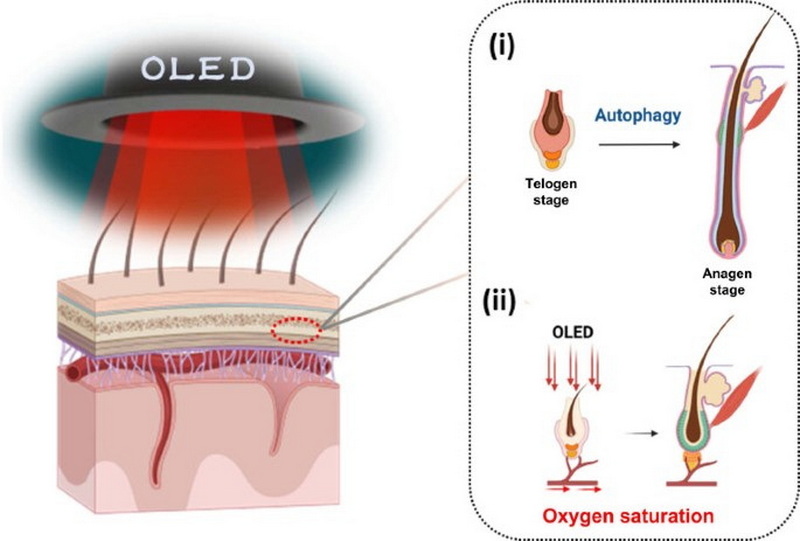 best red light therapy device for hair growth_2