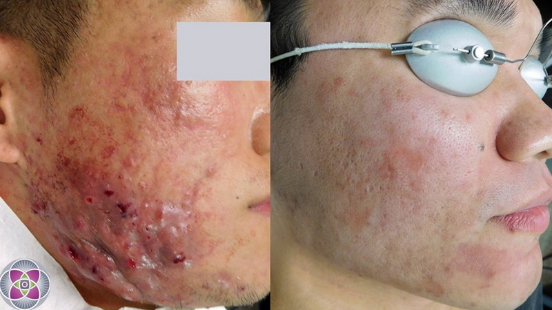 amazon red light therapy panel_2