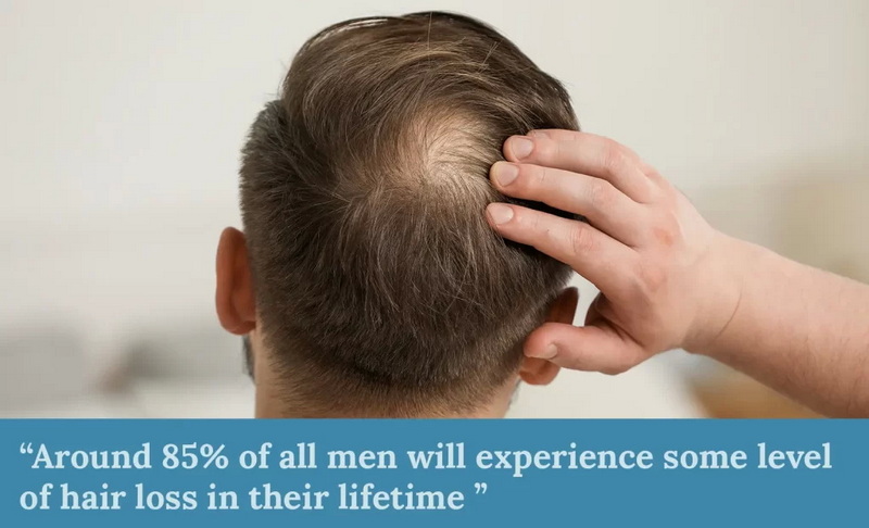 best red light therapy device for hair loss_1