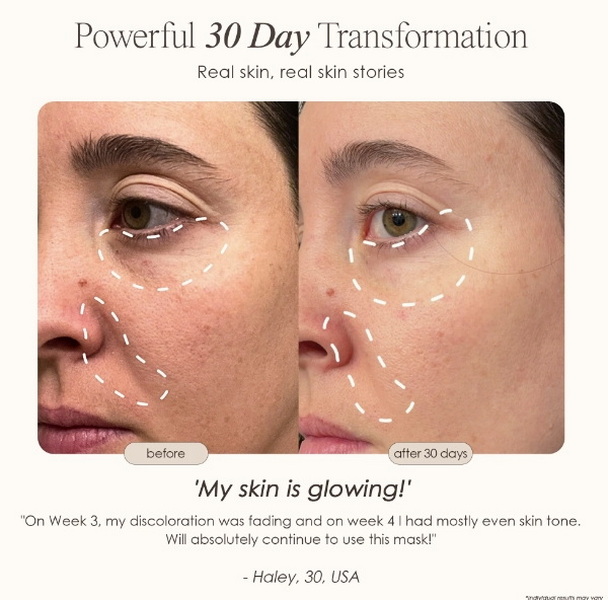 does led face mask light therapy work_2