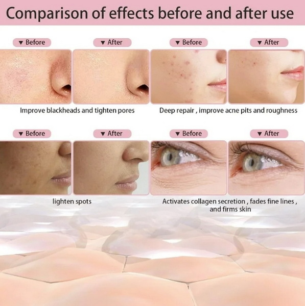 can led face mask cause spots_3