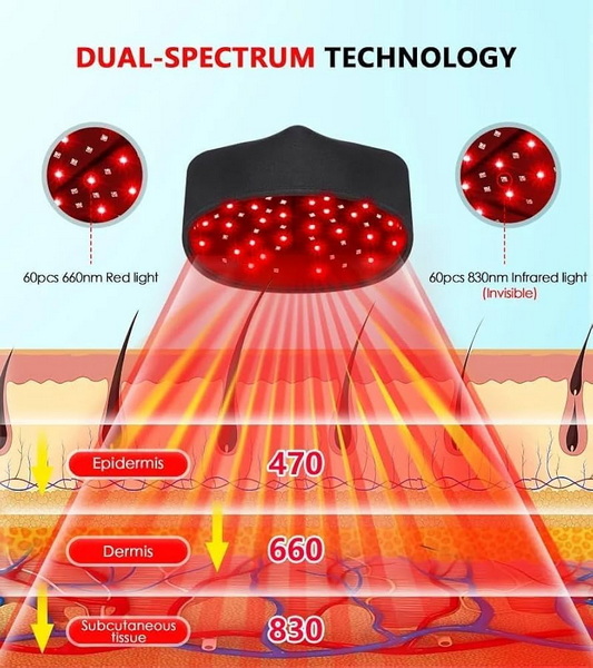 Is Red Light Therapy Safe for Hair and Scalp