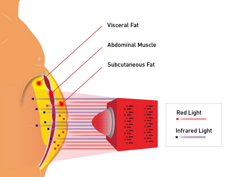 at home fat burning red light therapy device_3